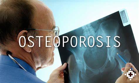 osteo